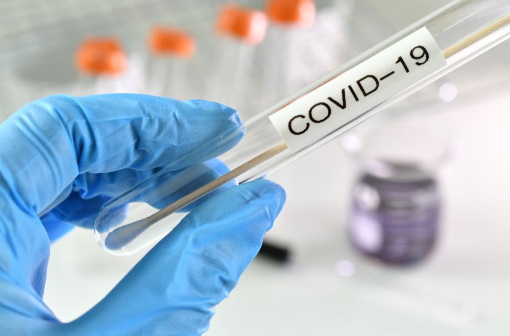 Τεστ Αντιγόνου COVID – 19 (RAPID TEST) – ΙΑΤΡΙΚΗ ΦΡΟΝΤΙΔΑ